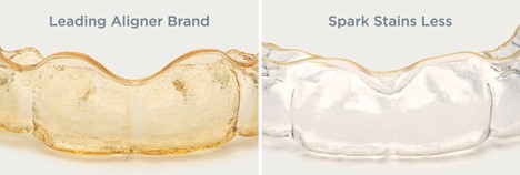 Comparison of staining between leading aligner and Spark clear aligner.